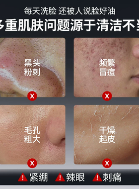 仁和匠心水杨酸洗面奶男士专用祛痘控油保湿除螨深层清洁面乳正品