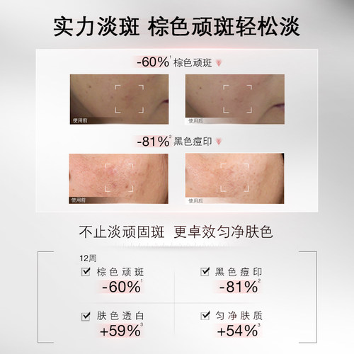 【88VIP专属】修丽可淡斑发光瓶 烟酰胺淡斑淡痘印提亮祛斑 - 图3