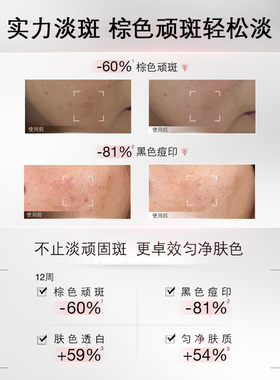 【烈儿宝贝】修丽可淡斑发光瓶 美白祛斑提亮官方正品O