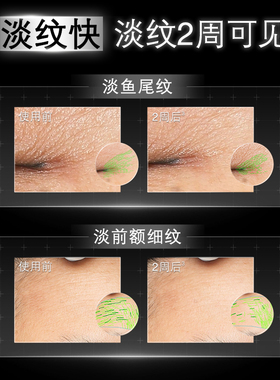 修丽可抗皱精华淡鱼尾纹法令纹