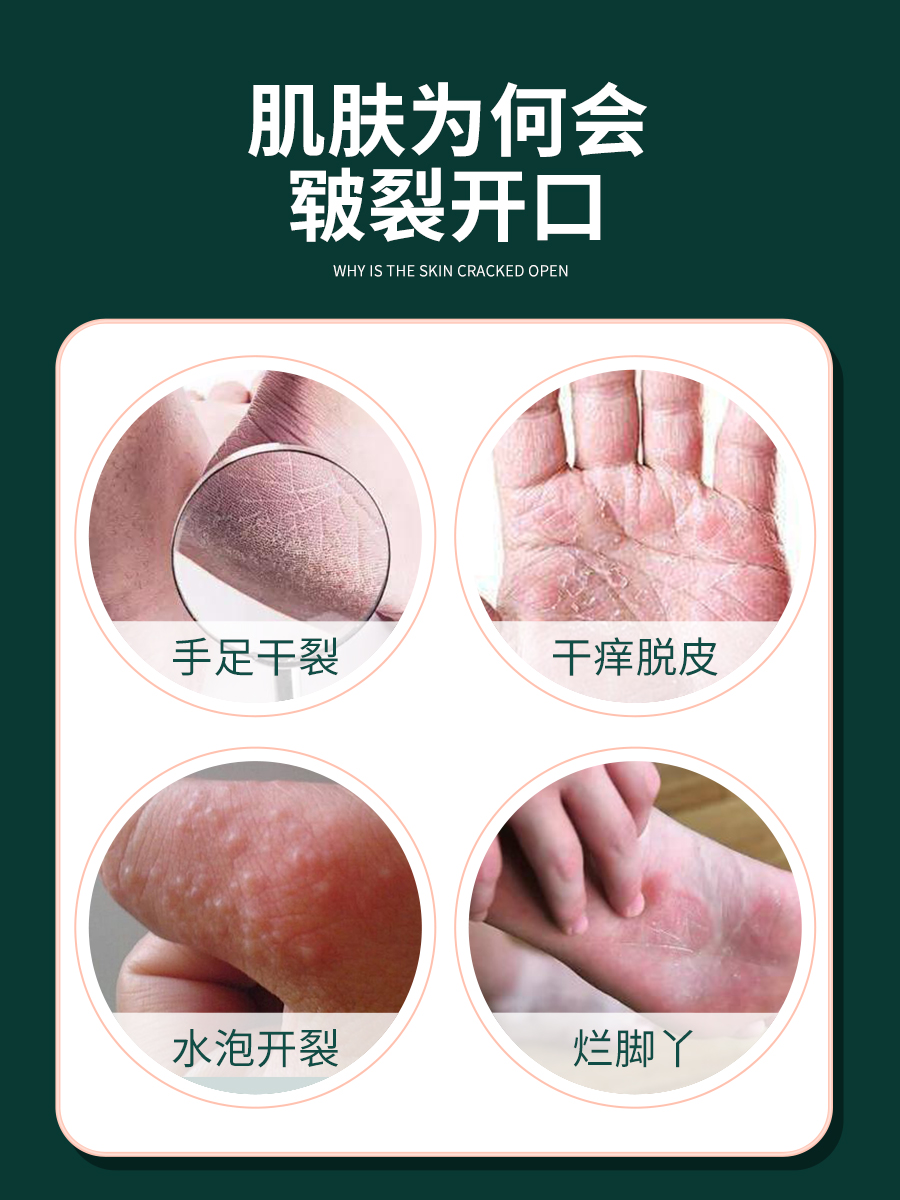 爱丽美居家日用专营店正品黄皮肤艾草生姜乳膏脱皮裂黄皮夫止痒抑菌护理软膏2