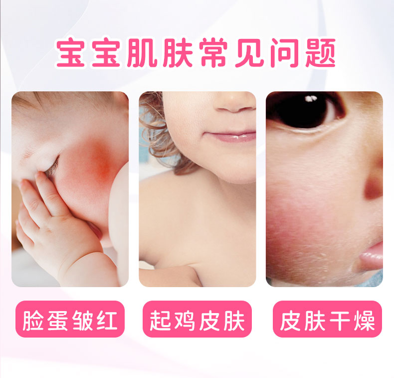 爱丽美居家日用专营店儿童尿素霜去鸡皮肤药店保湿防裂脸用维E护手霜鹤叔推荐3