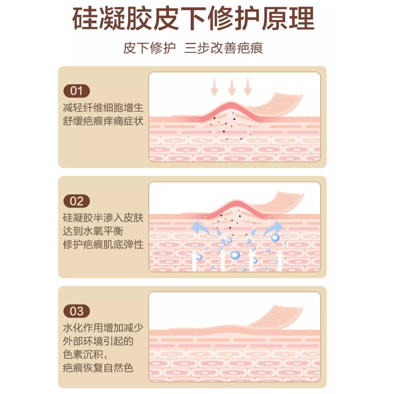 医用剖腹产疤痕贴硅凝胶疤预防增生烫伤点痣痘印刨腹产手术儿童-图3