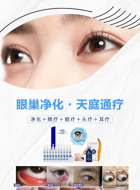 Faronae法朗妮眼巢净化保湿舒缓明眸清润眼部护理专用缓解疲劳