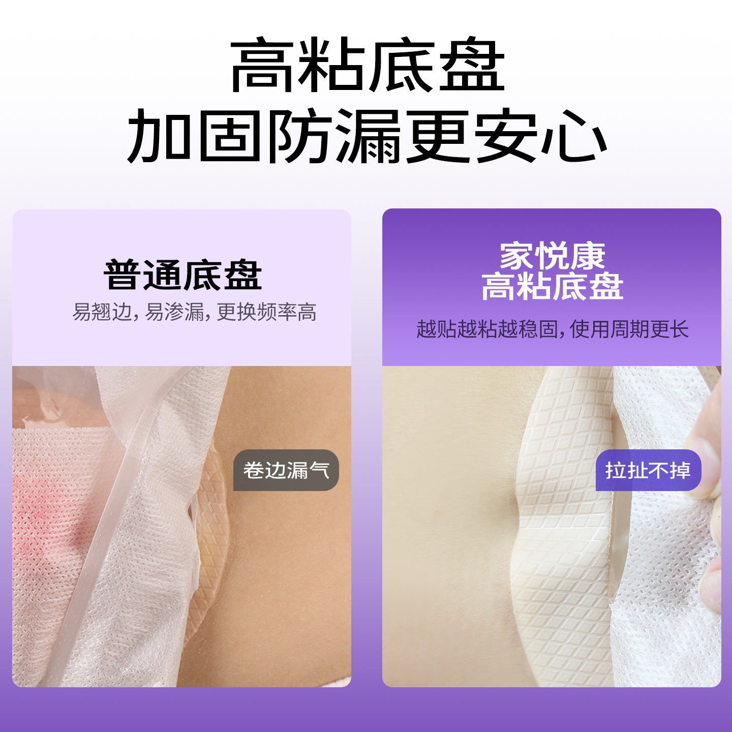 一次性造口袋直肠改道新款医院同款医用可排气夹子人工造瘘大便袋,淘宝优惠券,粉丝福利购,淘宝优惠卷