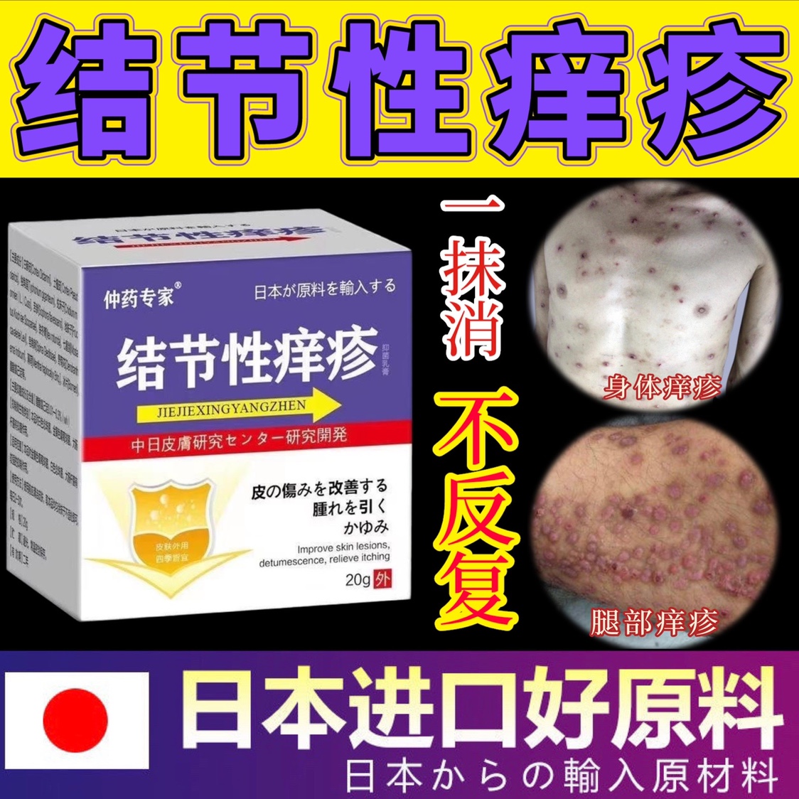 结节性痒疹特效治顽固性结节硬疙瘩断祛根湿疹皮炎皮肤病止痒药膏-图0