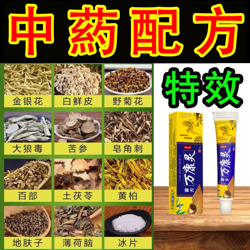 治疗汗泡疱疹专用软膏手上起小水泡汗状疱疹止痒药膏汉状真菌感染 - 图1