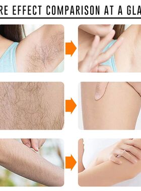 2 Minutes Fast Hair Removal Spray Painless Hair Growth