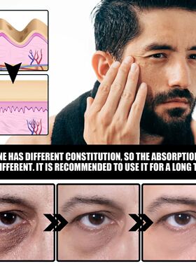 Anti Aging Eye Cream Men Dark Circles Puffy Eyes Treatments