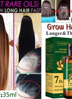 1pcs Ginger Hair Growth Products Anti Hair Loss Serum