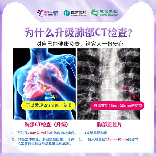 美年大健康瑞慈体检套餐慈铭女性男士全身检查 - 图3