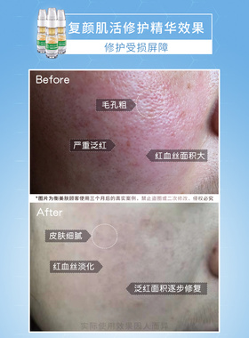 衡美肤增厚淡化红血丝正品精华露