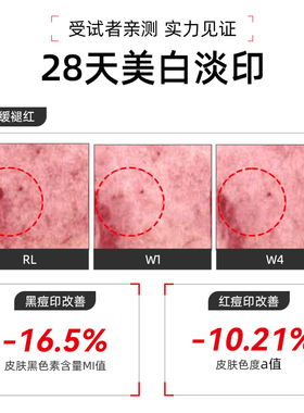 珀芙研传明酸净白淡斑次抛精华液