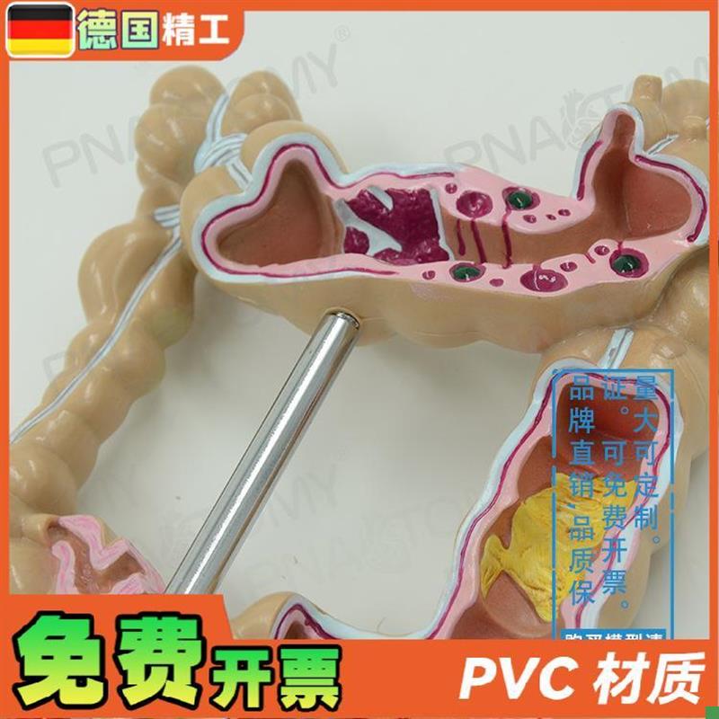 德国】仿真人体结肠大肠解剖模型肛肠科肠道肠胃消Z化系统教学 - 图1