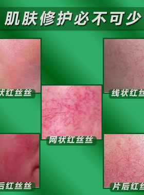 积雪草纯露湿敷水舒缓修护