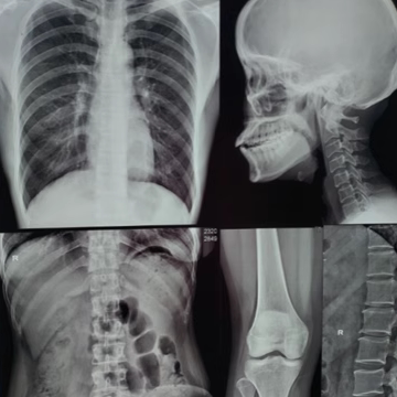 X-ray CT film printing dental viewing film