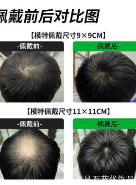 假发片男全真发创意真发补发真发片补发片递针旋遮家用收纳
