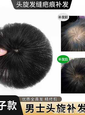 个性遮秃发片顶头旋发缝疤痕假发片男全真发头顶补发家用收纳
