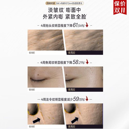 【保价双11】丝可光雕面罩美容仪面膜仪 EMS微电流LED大排灯提拉 - 图2
