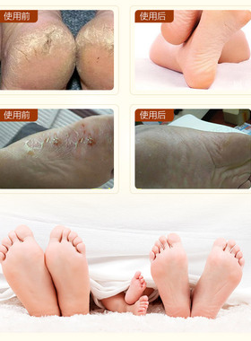新一代澜婷马油清足膏