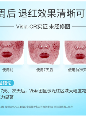 绽妍救急修红乳敏感肌缓解干痒红