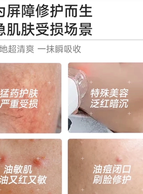 绽妍5分钟速修精华修红修护屏障