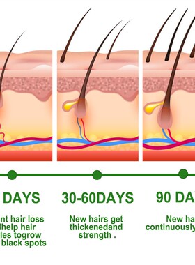 Rosemary Hair Care Essential Oil Growth Serum Anti Hair Loss