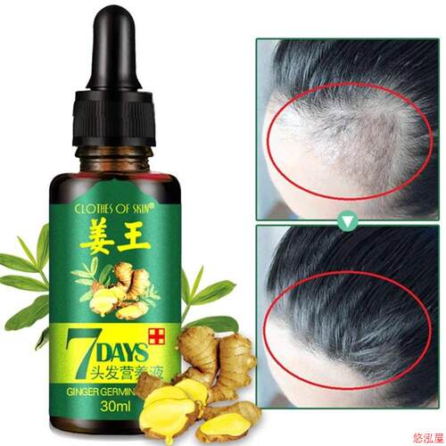 7 Days Powerful Hair Growth Products Essential Oil Beard - 图0