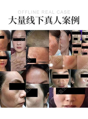 复合酸精华液精华霜 美容院黄褐3577熊果苷烟酰胺 淡去美祛白色斑