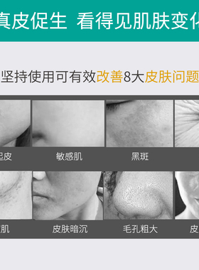 耐驰奥抗衰淡化细纹抗皱