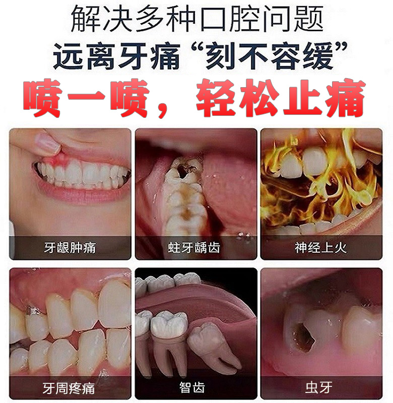 云南本草牙痛宁喷雾剂药智齿上火抗菌蛀虫牙疼牙龈肿止疼护理专用 - 图2