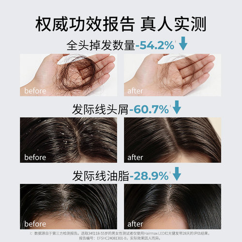 Hairmax健发小光环LED24发箍发际线头发毛发护理仪健发小光环 - 图1