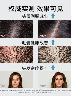 HairmaxU9束健发梳生发仪