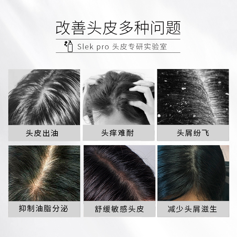 张若昀X舒蕾Pro氨基酸洗发水控油去屑止痒柔顺修护舒缓头皮洗发露