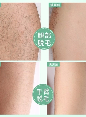 女士蜜蜡脱毛男士脸部美容院专用发际线热蜡去毛脸部脱毛学生除毛