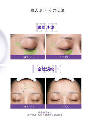 欧莱雅紫熨斗全脸玻尿酸黑眼圈眼霜 泓沁化妆品眼霜