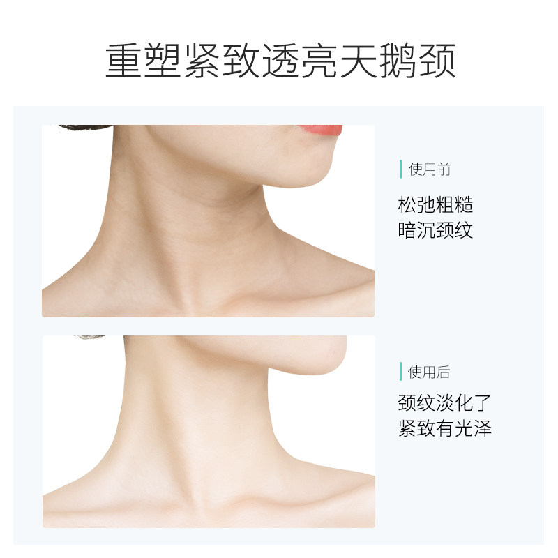 梵西滚轮【3瓶】颈纹神器保湿颈霜 fonce梵西七音符颈霜