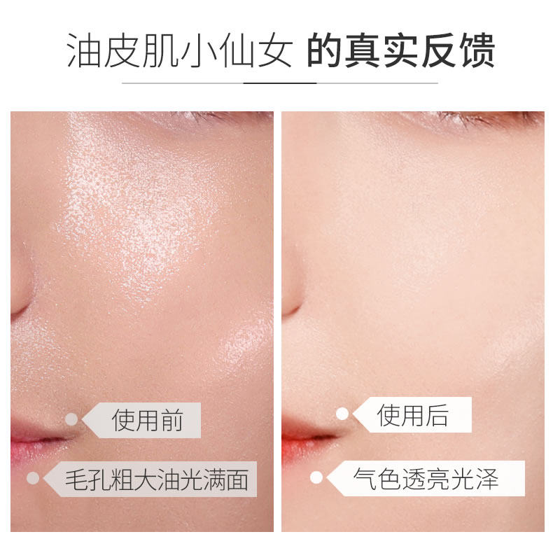 梵西金盏花水调理闭口粉刺女爽肤水 fonce梵西七音符化妆水/爽肤水