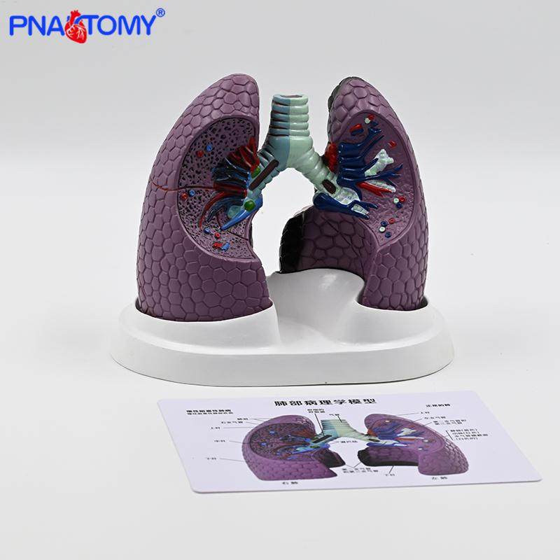 人体肺模型 吸烟病变肺 呼吸科标本健康肺胸外科肺部解剖健康教学 - 图0