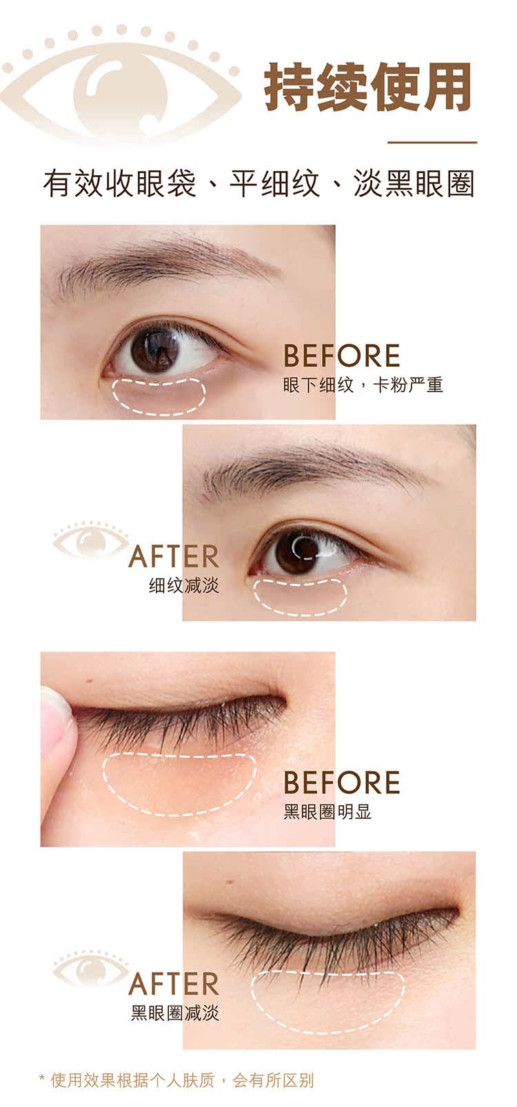 韩国梦诗肌Dream Skin眼部精华液 解救黑眼圈消眼袋减鱼尾纹 - 图1