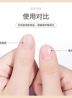美甲营养笔 护甲油指缘防倒刺手去死皮修复美甲边缘 护理防断滋养