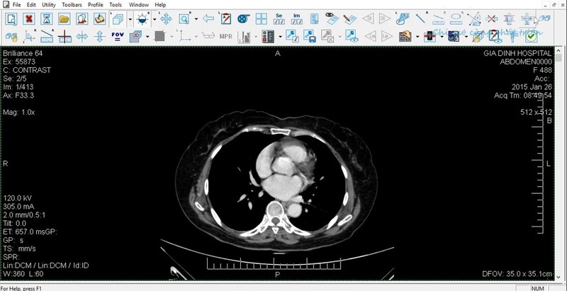 eFilm医学影像放射看图可打印eFilm Workstation DICOM DCM IMA - 图1