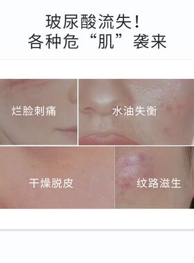 ZUZU玻尿酸原液初瑞瑞雪大活水能量补水保湿面部原液抗皱收缩毛孔