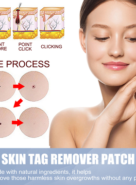 144Pcs Skin Tag Remover Patches Mole Wart Removing Sticker N