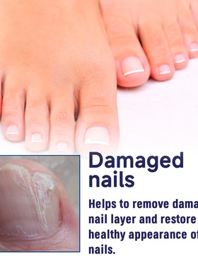 Toe Patch Is Gentle, Comfortable, Moisturizing And Curing Na