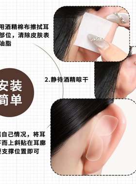 蝶翼型隐形精灵耳贴强支撑