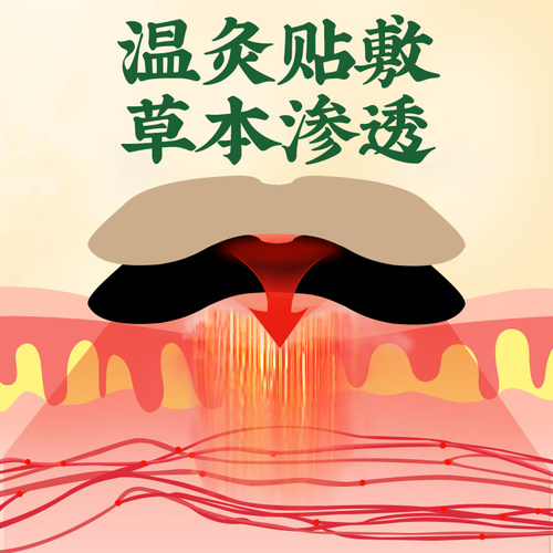 官方旗舰店艾草贴膝盖贴正品艾灸贴膝盖发热贴关节艾灸艾叶护膝帖 - 图1