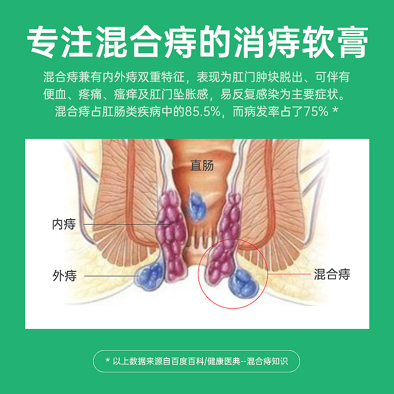 混合痔卡波姆痔疮凝胶消痔软膏外肉球 医用敷料去断肛门膏正品 - 图0