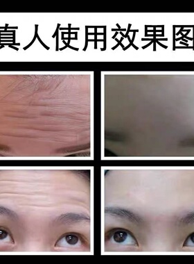 祛皱纹美白神器去除抬头纹男女提拉紧致六胜肽抗皱美白面霜抗衰老