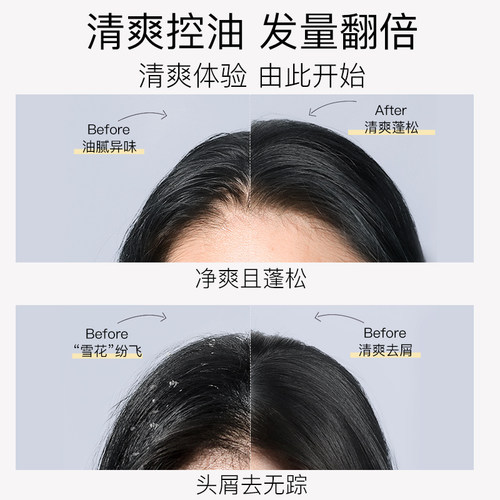 NIOXIN丽康丝洗发水2号无硅油防掉发清爽控油去油蓬松去屑300ml - 图3